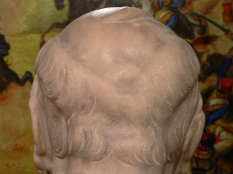 Görgey fejsebe a Semmelweis múzeumban lévő szobron